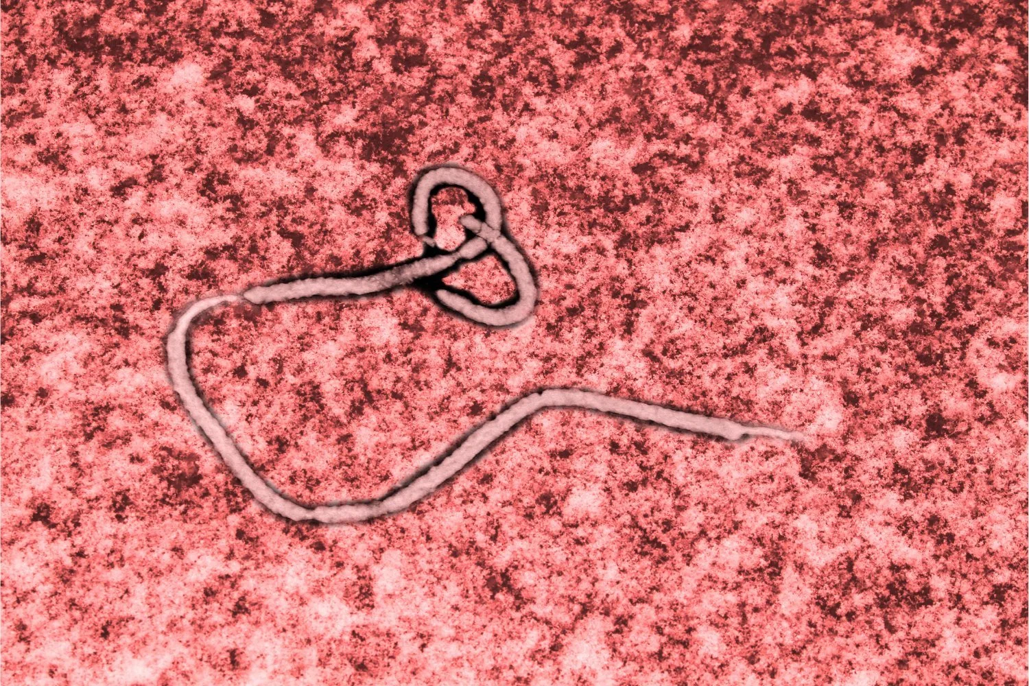 A Pill for Ebola? New Drug Shows Up to 100% Survival in Monkeys
