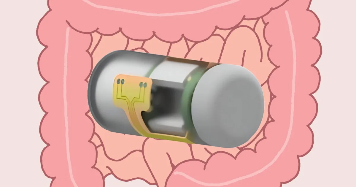 This ingestible smart capsule can wirelessly monitor gut health in real time
